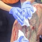 Amare Padel Accident Suspected of Poor Safety Standards Enters Legal Matters