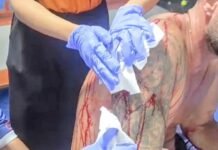 Amare Padel Accident Suspected of Poor Safety Standards Enters Legal Matters